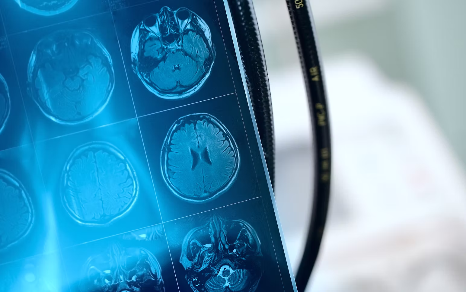 Prognostic and Predictive Clinical Response